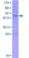 Human PIGL Protein (Recombinant GST)