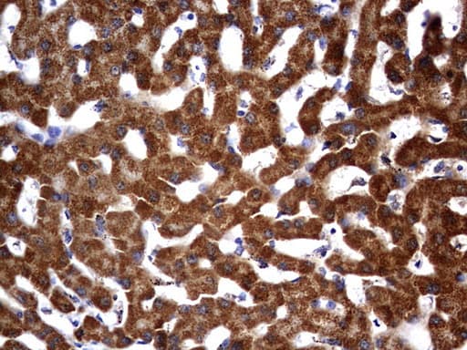 Monoclonal Mouse anti-Human OTC Antibody (clone OTI5F4, aa33-354, IHC, WB)