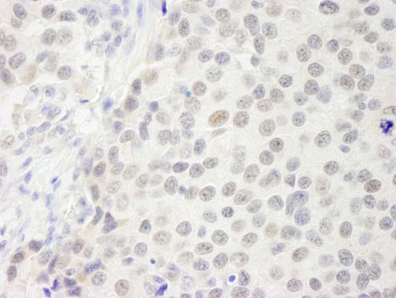 GATAD2B Antibody (aa50-100)