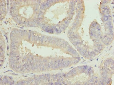 Polyclonal Rabbit anti-Human CLGN / Calmegin Antibody (IHC, WB)