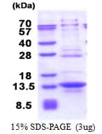 Human IRF5 Protein (Recombinant His)