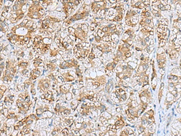 NQO2 Antibody