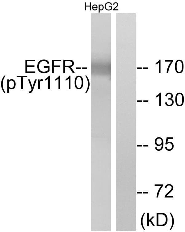 EGFR Antibody (phospho-Tyr1110)