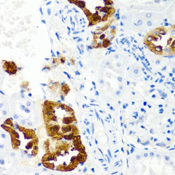 CST1 / Cystatin SN Antibody