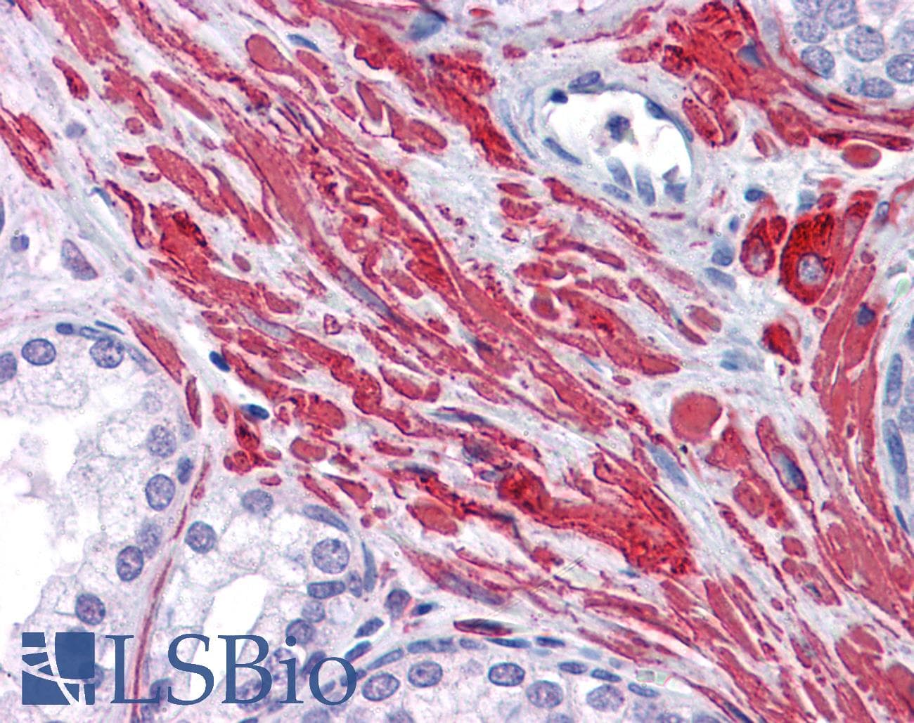 IHC-plus™ Polyclonal Goat anti-Human DES / Desmin Antibody (aa454-468, IHC, WB)