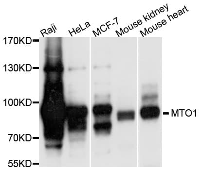 Polyclonal Rabbit anti-Human MTO1 Antibody (WB)