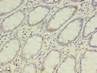 DPH2 Antibody (aa1-489)