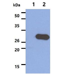Monoclonal Mouse anti-Human STOM / Stomatin Antibody (clone AT33F5, WB)