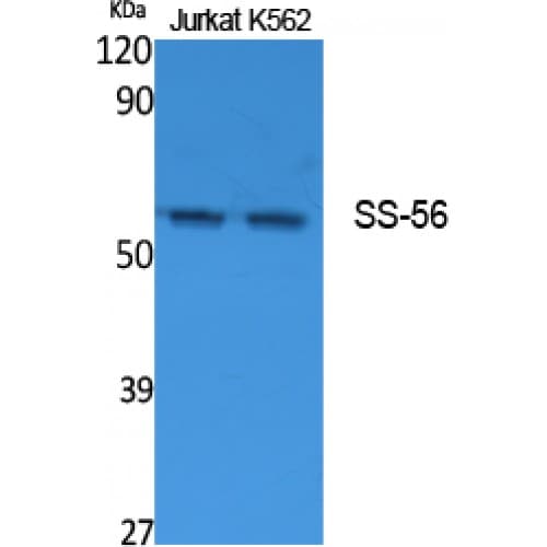 TRIM68 Antibody (Internal)