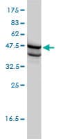 Monoclonal Mouse anti-Human SSB / La Antibody (clone 1D6-H5, WB)
