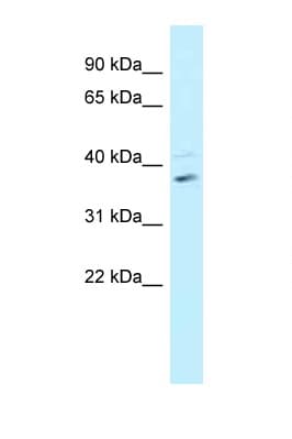 Polyclonal Rabbit anti-Human BRCC3 / BRCC36 Antibody (C-Terminus, WB)