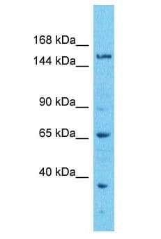 Polyclonal Rabbit anti-Human EFCAB5 Antibody (aa1235-1284, WB)