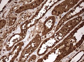 Monoclonal Mouse anti-Human GAPDH Antibody (clone OTI2F8, IHC, WB)