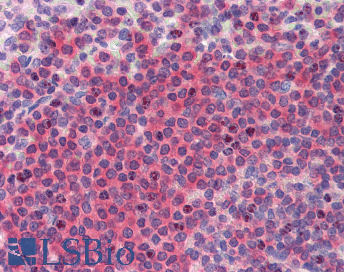 IHC-plus™ BRCC3 / BRCC36 Antibody (clone AT3B1)