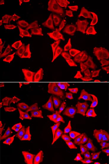 Polyclonal Rabbit anti-Human THRSP Antibody (IHC, IF, WB)