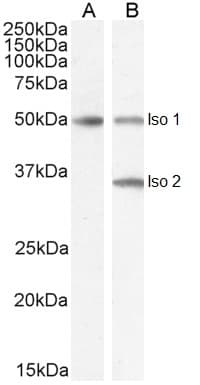 IHC-plus™ Polyclonal Goat anti-Human CHGA / Chromogranin A Antibody (aa85-97, IHC, WB)