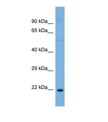 ST8SIA1 Antibody (N-Terminus)