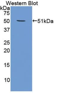 PSMC4 Antibody (aa1-418, HRP)