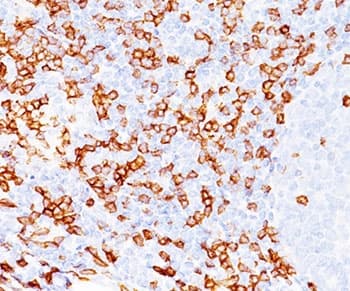 CD8A / CD8 Alpha Antibody (clone C8/468, Ready-to-Use)