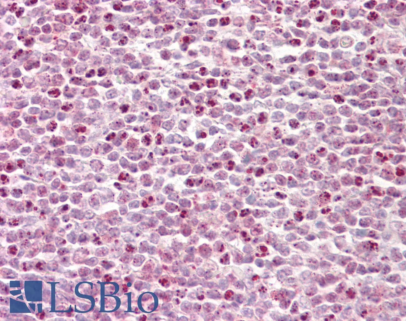 IHC-plus™ HCF1 / HCFC1 Antibody (aa131-180)