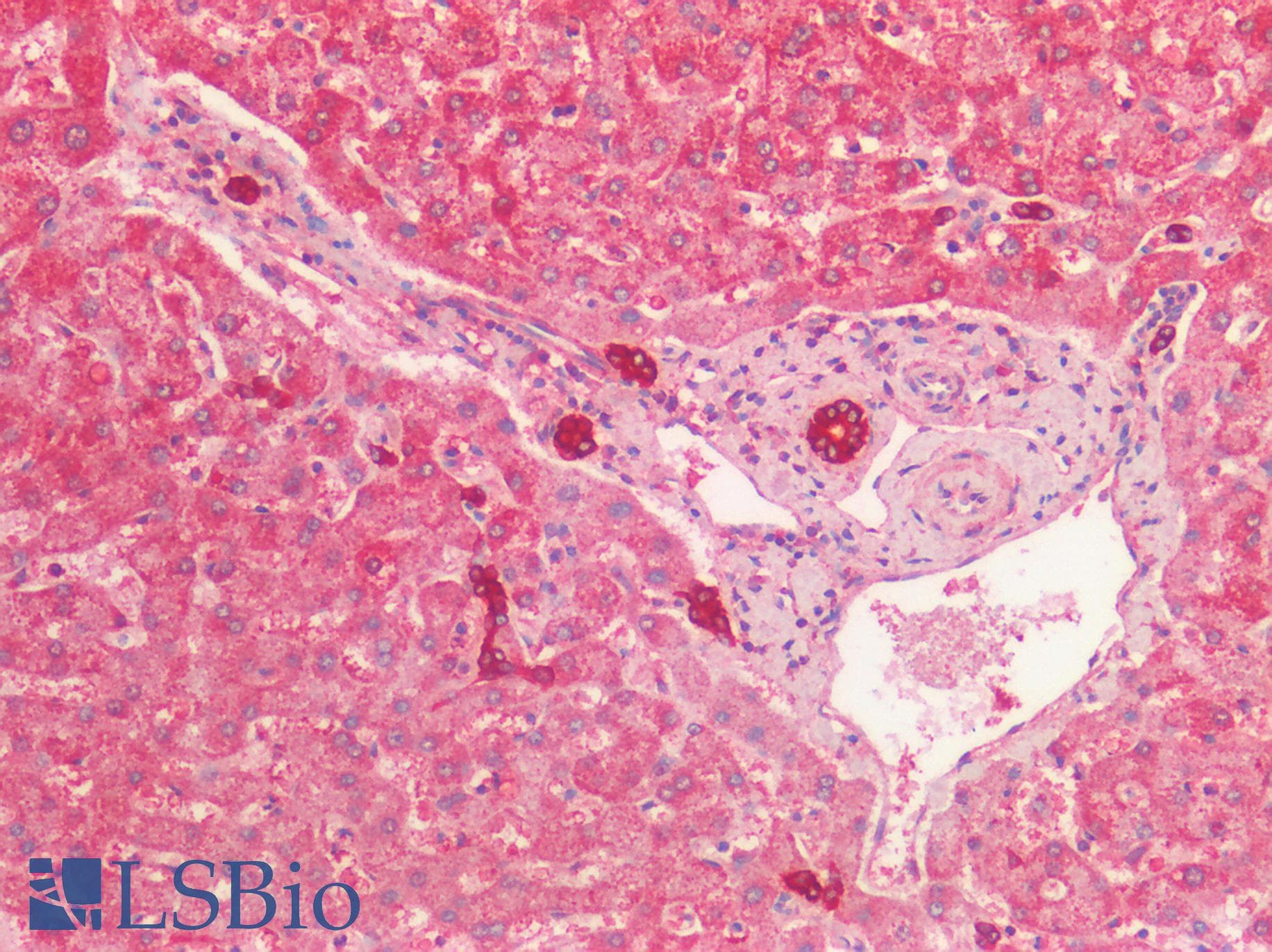 IHC-plus™ KRT19 / CK19 / Cytokeratin 19 Antibody (aa285-298)