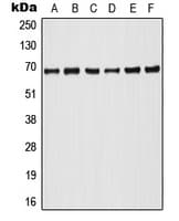 ARAF / ARAF1 / A-RAF Antibody (phospho-Tyr302)