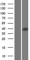 SHBG Protein (Over-Expression Lysate Myc-DDK (Flag))