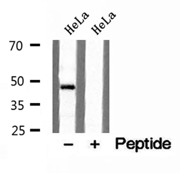 PLIN3 / M6PRBP1 / TIP47 Antibody