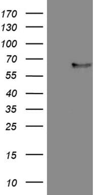 FCRLB / FREB-2 Antibody (aa202-426, clone OTI1D7)
