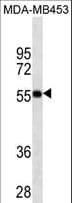 Monoclonal Mouse anti-Human Vitamin D Receptor / VDR Antibody (WB)