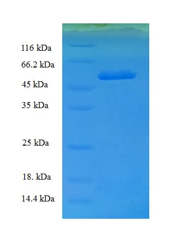 Human TFIIB Protein (Recombinant His-SUMO)