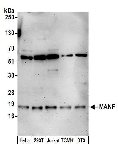 MANF / ARMET Antibody (aa1-50)