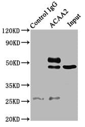 ACAA2 Antibody