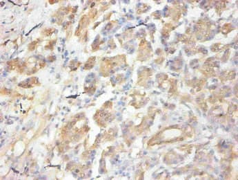 Monoclonal Mouse anti-Human CCL2 / MCP1 Antibody (WB)