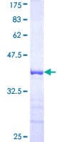 Human USP12 Protein (Recombinant GST, N-terminus)