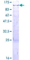 Human TNIP1 Protein (Recombinant GST)