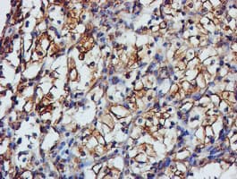TUBAL3 Antibody (clone OTI5E4)