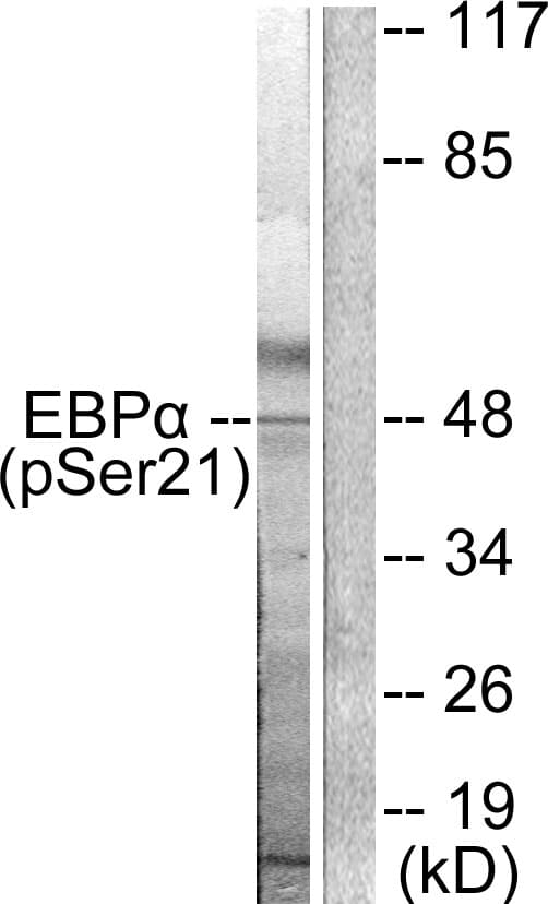 Polyclonal Rabbit anti-Human C/EBP Alpha / CEBPA Antibody (phospho-Ser21, IHC, WB)