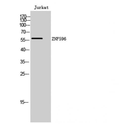 ZNF596 Antibody (230-310 aa, Internal)