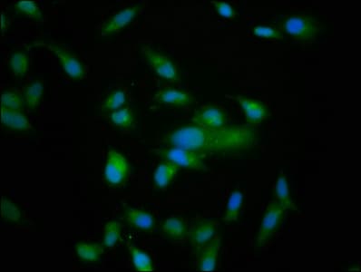 Polyclonal Rabbit anti-Human NRD1 / Nardilysin Antibody (IF, WB)