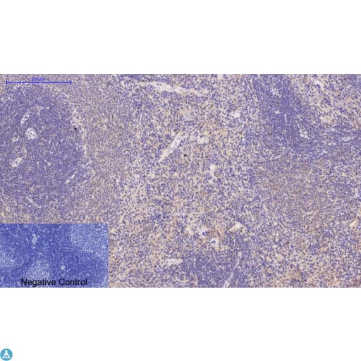 DES / Desmin Antibody