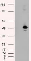 TLDC1 / KIAA1609 Antibody (clone OTI7E4)