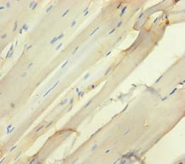 Polyclonal Rabbit anti-Human SEMA5A / Semaphorin 5A Antibody