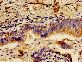 LCT / Lactase Antibody