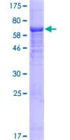 Human IFI44L Protein (Recombinant GST)