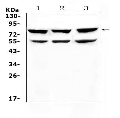 TNFRSF11A / RANK Antibody