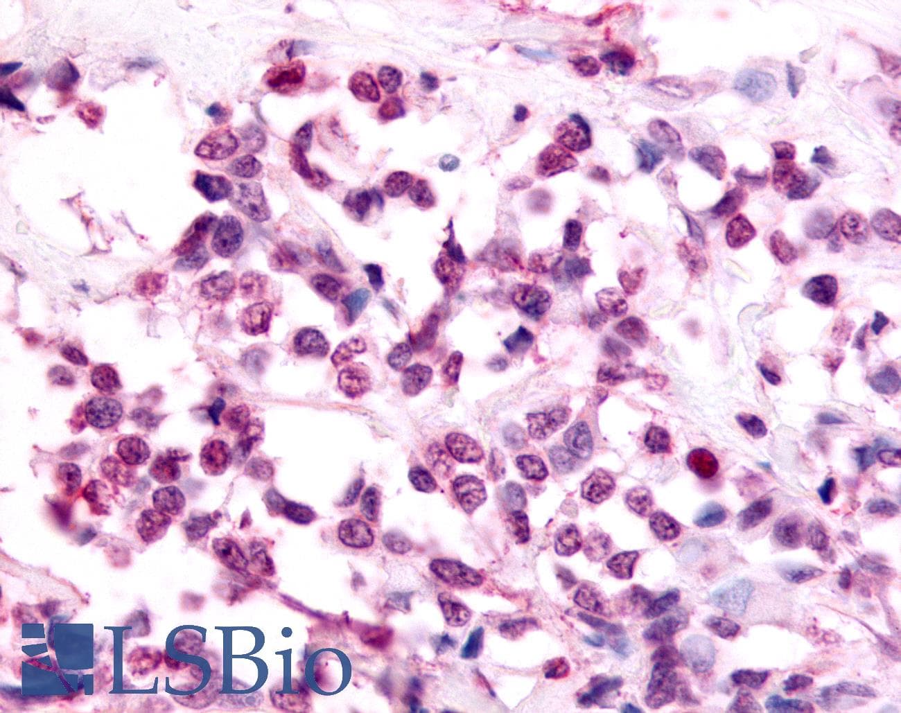IHC-plus™ Polyclonal Rabbit anti-Human EAR2 / NR2F6 Antibody (Ligand-binding Domain, IHC)