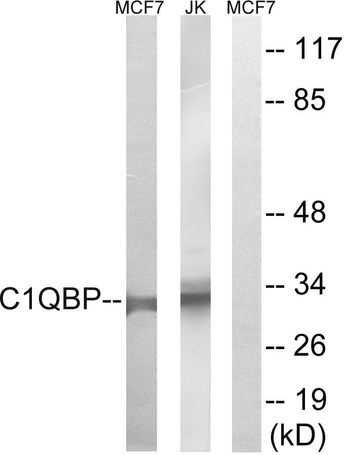 Polyclonal Rabbit anti-Human GC1qR / C1QBP Antibody (IHC, WB)