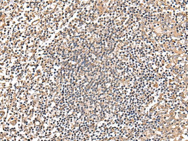 Polyclonal Rabbit anti-Human MRPS18C Antibody (IHC, WB)