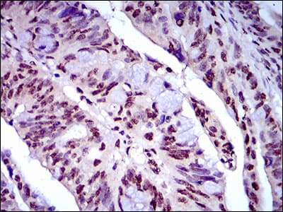 Monoclonal Mouse anti-Human NAPSA / NAPA / Napsin A Antibody (clone 10C4B8, aa20-158, IHC, WB)